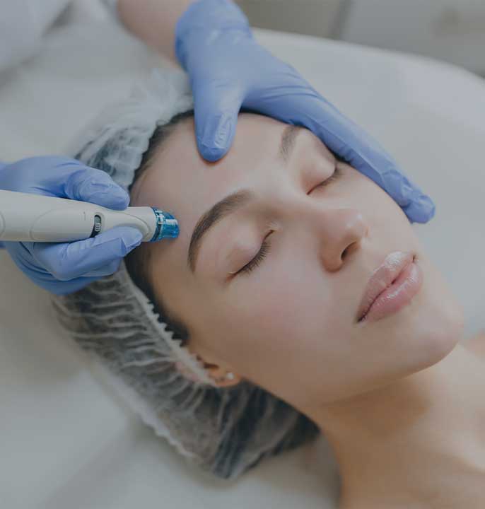 Microneedling Behandlung in Hannover - MediArtPraxis