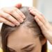 Was tun bei Haarausfall? Ursachen verstehen und Behandlungen